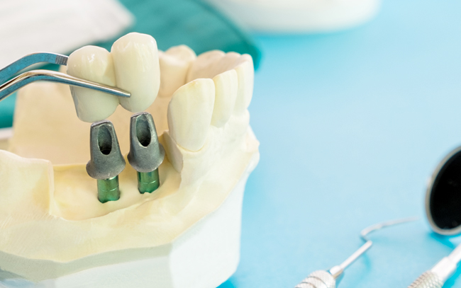 Servizi Odontoiatrici