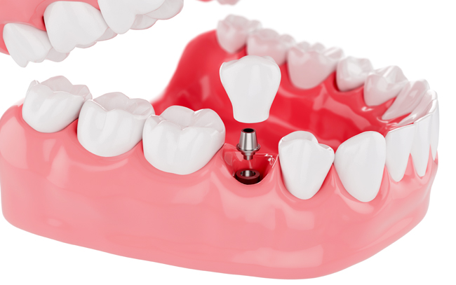 Servizi Odontoiatrici